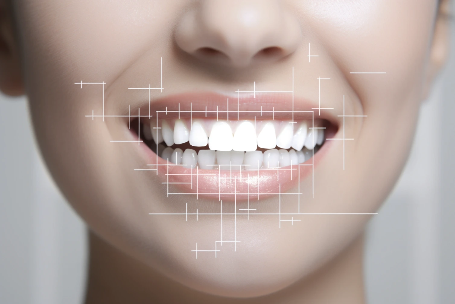 cost of teeth whitening