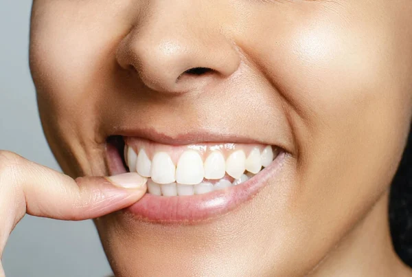 Exploring Natural and Organic Teeth Whitening Options