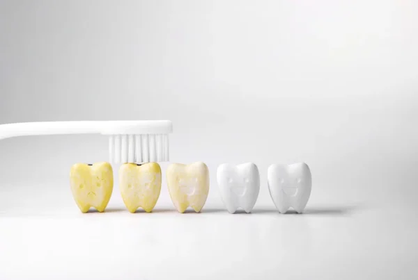 How LED-Activated Whitening Systems Are Revolutionizing Results