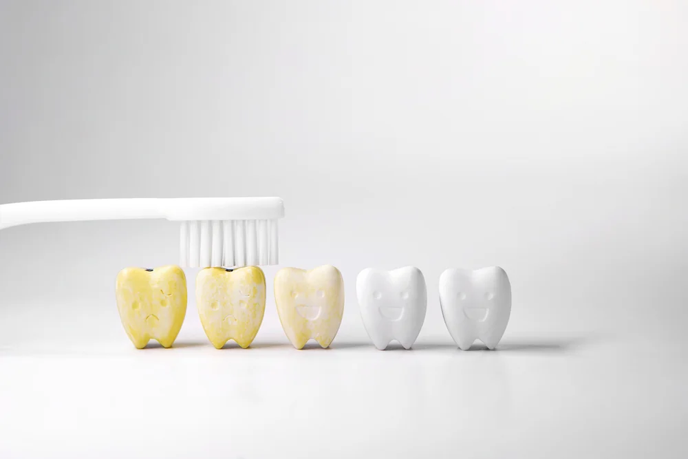 How LED-Activated Whitening Systems Are Revolutionizing Results