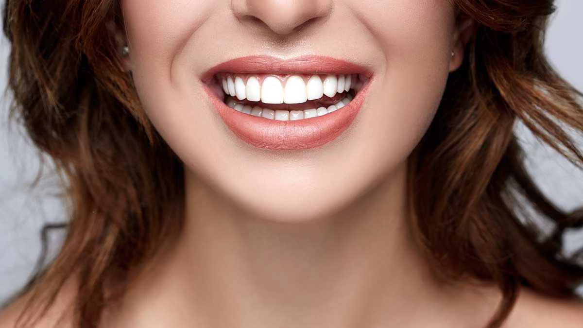 Replacing Veneers: When and Why You Should Consider It